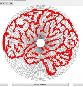 spovBrain1